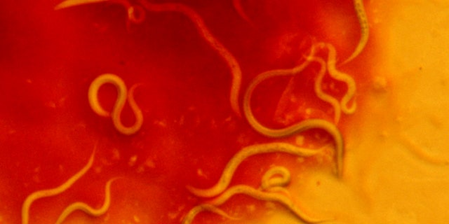 C. elegans crawling on deadly S. marcescens bacteria in a petri dish.