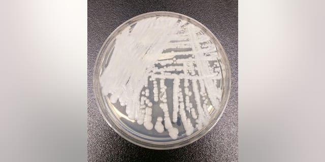 A strain of Candida auris cultured in a petri dish at CDC.