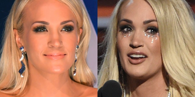 Carrie Underwood before (left) and after her fall.