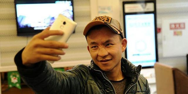 Li Ming poses for his first selfie after surgeons gave him a new nose.