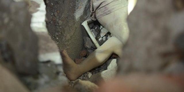 One leg of a young girl who survived the collapse of buildings is seen in the rubble.
