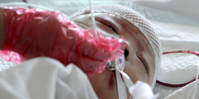 Oct. 16, 2011: A nurse takes care of a two-year-old girl identified as Wang Yue in a hospital in Guangzhou in south China's Guangdong province.