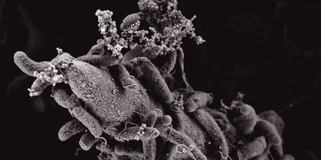 This electron scanning microscopy image show Vibrio cholerae bacteria attached to a chitin surface.