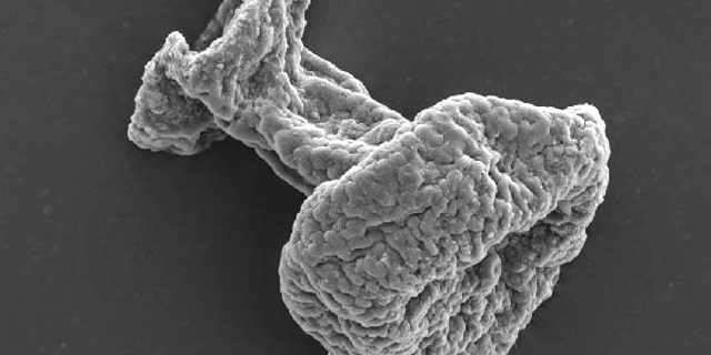 This microscopic fossil closely resembles a modern tintinnid, a single-celled organism that is a type of plankton. Fossil ciliates including this one were recently identified in a deposit in Mongolia, and they are more than 100 million years older than the previously known fossils of this type.