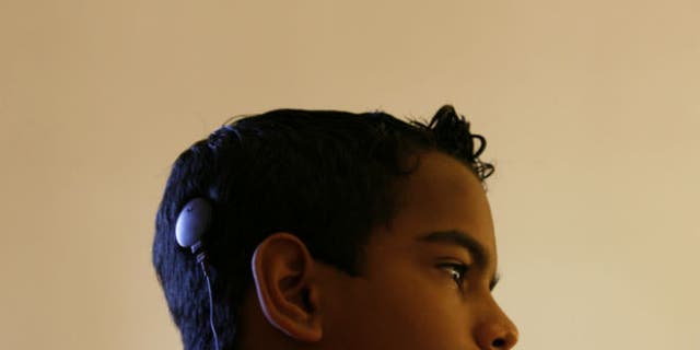 A child with a cochlear implant. REUTERS/Claudia Daut