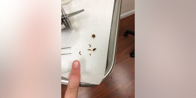 A trip to the ENT revealed that several pieces of the bug were still in her ear.