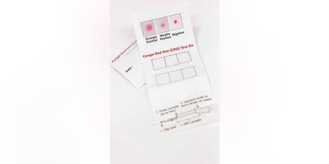 The Congo Red Dot Test, which researchers say can be used to test pregnant women for preeclampsia.