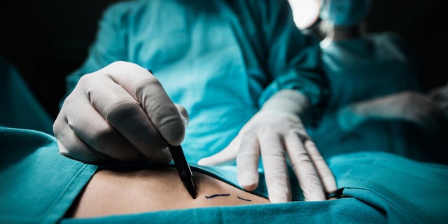 cosmetic_surgery_2