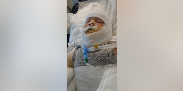Kayden is in an induced coma at University Hospital in San Antonio.