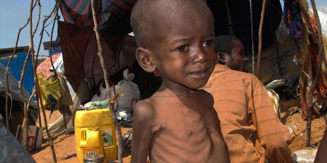 A Somali malnourished child from southern Somalia stands in front of a makeshift shelter in Mogadishu, Somalia, Saturday, July 23, 2011.