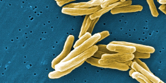 This scanning electron micrograph (SEM) depicts some of the ultrastructural details seen in the cell wall configuration of a number of Gram-positive Mycobacterium tuberculosis bacteria.