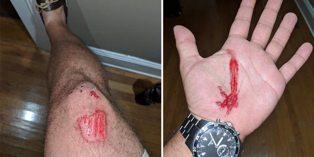 An Uber passenger claimed he was assaulted by his driver on Saturday after commenting on how fast he was going.