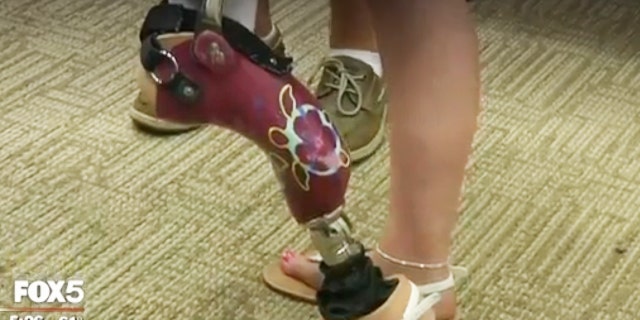 The procedure allows for a more natural bend in Unger's leg, which enables her to participate in any activity she wants, including dance.