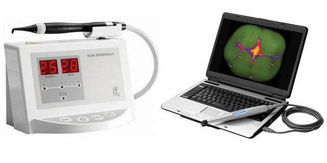 Emerging devices like Kavos popular Diagnodent (left) and Air Techniques Spectra (right) have been accused of helping dentists drum up business with unnecessary drillings.