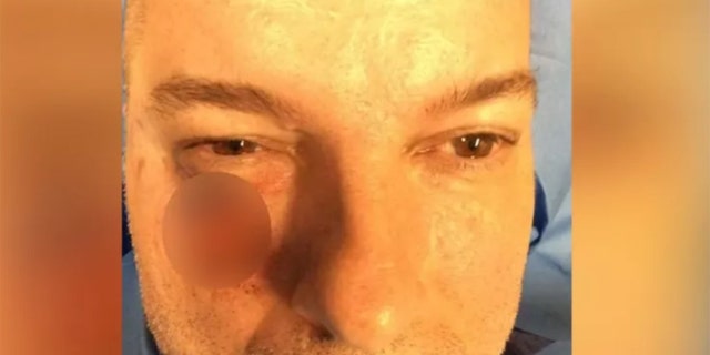 Shawn Montgomery visited the dermatologist after his dentist spotted discoloration on his face.