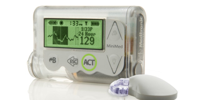 October 2012: This image provided by Medtronic shows the MiniMed Integrated System device, which doctors are reporting as a major step toward an "artificial pancreas."