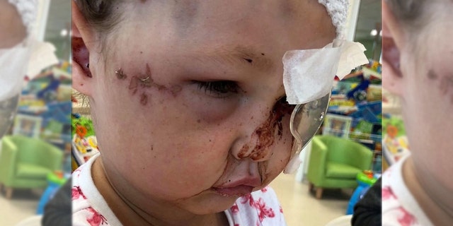 Police say a 40-year-old woman, from Lancashire, England, has been arrested in connection with Tillie's mauling.
