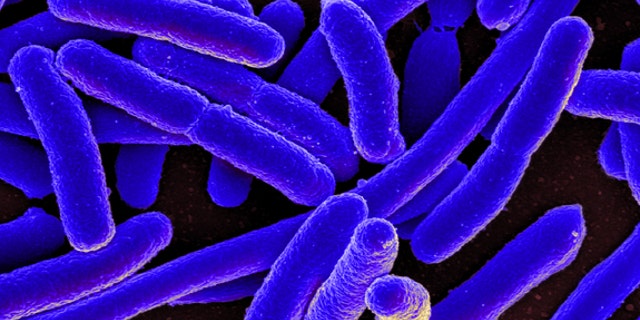Colorized scanning electron micrograph of Escherichia coli bacteria, grown in culture and adhered to a cover slip.