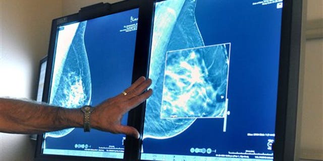 FILE - In this file photo, a radiologist compares an image from earlier, 2-D technology mammogram to the new 3-D Digital Breast Tomosynthesis mammography.