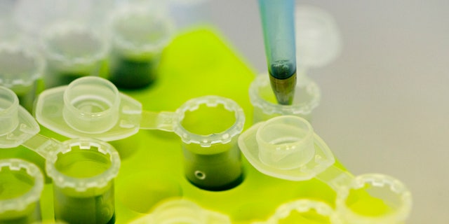 Laboratory technicans of the company Icon Genetics prepare proteines from Tobacco plants (Nicotiana benthamiana) for weighing in a laboratory in Halle, August 14, 2014. Icon Genetics develop a technology to mass produce Ebola vaccine with the help of tobacco plants. REUTERS/Axel Schmidt (GERMANY - Tags: HEALTH SCIENCE TECHNOLOGY) - RTR42FWM