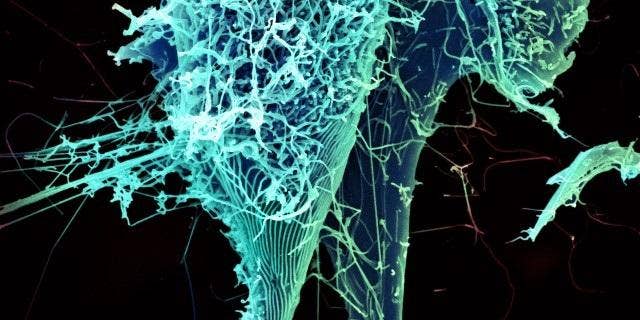 String-like Ebola virus particles are shedding from an infected cell in this electron micrograph.