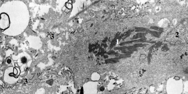 In this image, particles of Ebola virus are replicating in liver tissue.