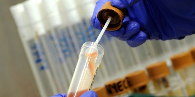 An employee examines a stool sample for EHEC bacteria (bacterium Escherichia coli) strains in the microbiological laboratory of the 'Universitaetsklinikum Hamburg-Eppendorf ' (University Cllinic Eppendorf- UKE) in the northern German town of Hamburg, June 2, 2011.