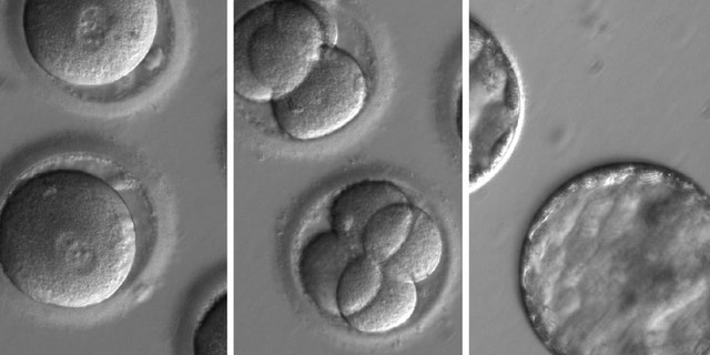 This sequence of images shows the development of embryos after co-injection of a gene-correcting enzyme and sperm from a donor with a genetic mutation known to cause hypertrophic cardiomyopathy. (OHSU)