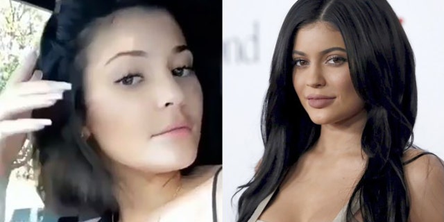 The "old Kylie" returned to social media Sunday as Jenner revealed that she removed her lip filler.