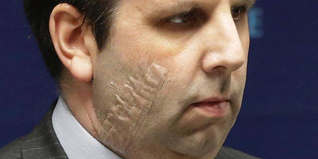 FILE - In this Tuesday, March 10, 2015, file photo, U.S. Ambassador to South Korea Mark Lippert listens to a question during a press conference before being discharged from Severance Hospital in Seoul, South Korea. South Korean prosecutors on Wednesday, April 1, 2015, indicted Kim Ki-jong, 55, who slashed Lippert in Seoul last month on charges of attempted murder. (AP Photo/Ahn Young-joon, File)