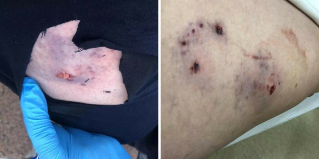 A woman said she was bit by a Secret Service dog outside a rally Vice President Mike Pence attended on Wednesday, August 8, 2018.