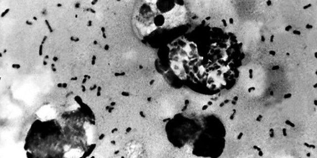 Bubonic plague bacteria in a photo obtained on Jan. 15, 2003 from the Centers for Disease Control and Prevention.