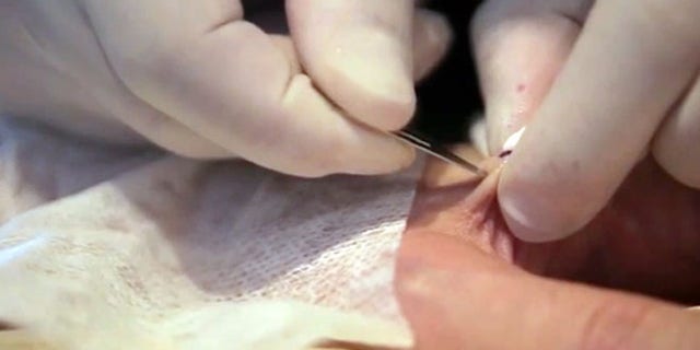 A tattoo artist implants a small RDIF chip into a man's hand.