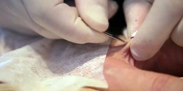 A tattoo artist implants a small RDIF chip into a man's hand.