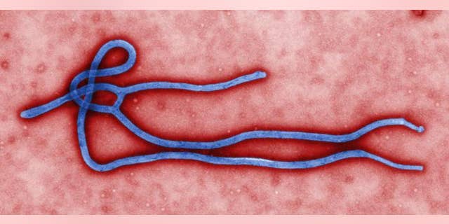 This photo provided by the CDC shows an ebola Virus. U.S. health officials are monitoring the Ebola outbreak in Africa but say the risk of the deadly germ spreading to the United States is remote. (AP Photo/CDC)