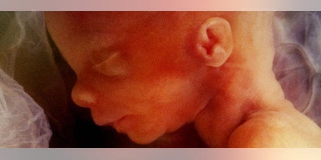 fetus in womb. Photo: Getty Images