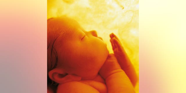 Anne Geddes photos
