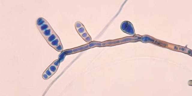 The fungus Exserohilum, pictured, has been found in some of the patients affected by the meningitis outbreak.