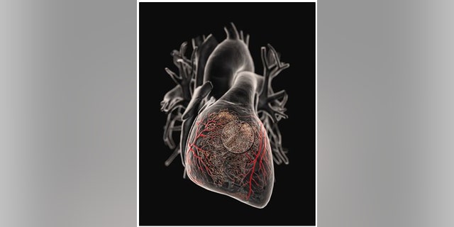 Doctors delivery gene-therapy products directly to the heart.
