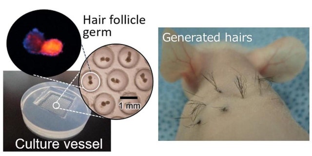 A team of scientists have discovered the use of a chemical found in McDonald's french fries can help grow hair follicles.