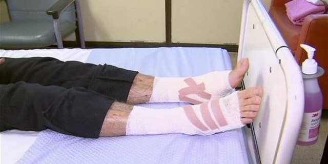 In this image made from video, legs of Sam Kanizay, 16, are seen on a bed of a hospital where he is treated, in Melbourne, Australia.