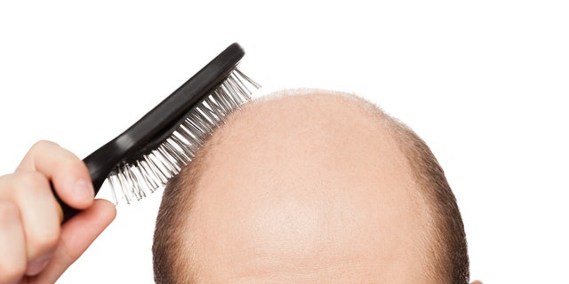 Why you're going bald — and how to get your hair back | Fox News Why you're going bald — and how to get your hair back | Fox News