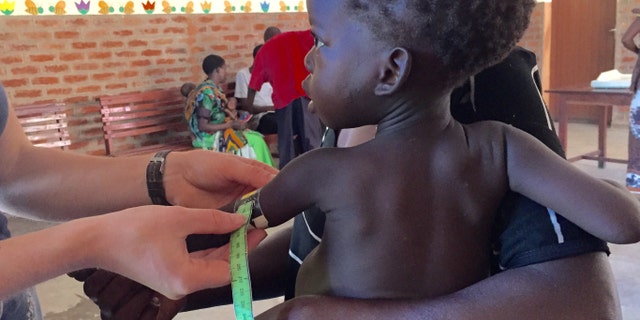 This photo provided by Washington University School of Medicine shows researchers measuring children's growth in Malawi. Researchers transferred gut bacteria from children into mice for tests that showed the right kind of bugs may protect against malnutrition by helping to get the most out of a poor diet. (Washington University School of Medicine/Kim Hedge via AP)