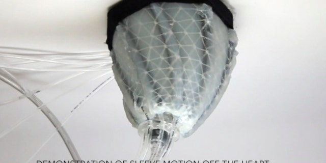 In this image from video, provided by Harvard University, a robotic sleeve designed to encase a diseased heart and gently squeeze it to help it better pump blood. Researchers at Harvard and Boston Childrenâs Hospital developed the experimental device in hopes of improving treatment of heart failure, when the heart becomes too weak to pump. (Ellen Roche/Science Translational Medicine via AP)