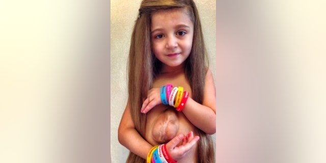 Virsaviya "Bathsheba" Borun is a 6 and a half year old girl who have a rare condition called Pantalogy of Cantrell.