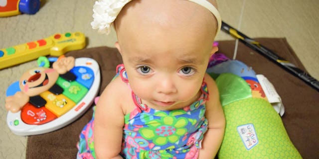 1-year-old battling rare bone disorder dies despite life-saving ...