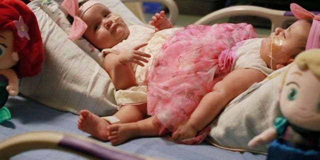 Ximena and Scarlett Hernandez-Torres (Driscoll Children's Hospital/Fox7)