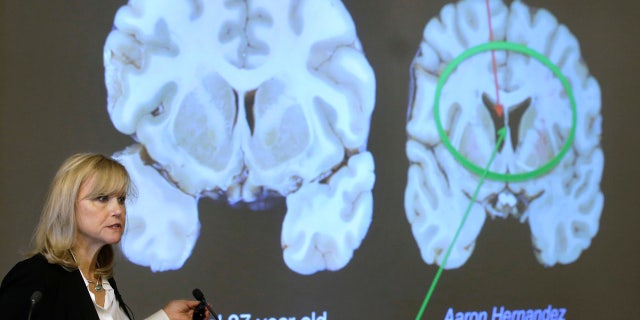 Ann McKee, director Boston University's center for research into the degenerative brain disease chronic traumatic encephalopathy, or CTE, addresses an audience on the school's campus Thursday, Nov. 9, 2017 about the study of NFL football player Aaron Hernandez's brain, projected on a screen, behind right, in Boston