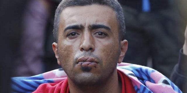 Several refugees have sewn their lips together with a cord.
