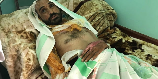 In one apparent torture case at a small hospital in Ma’rib, a man in his thirties, Mohammed, mumbled endlessly and incoherently to himself - his face and body awash with deep burns and scars